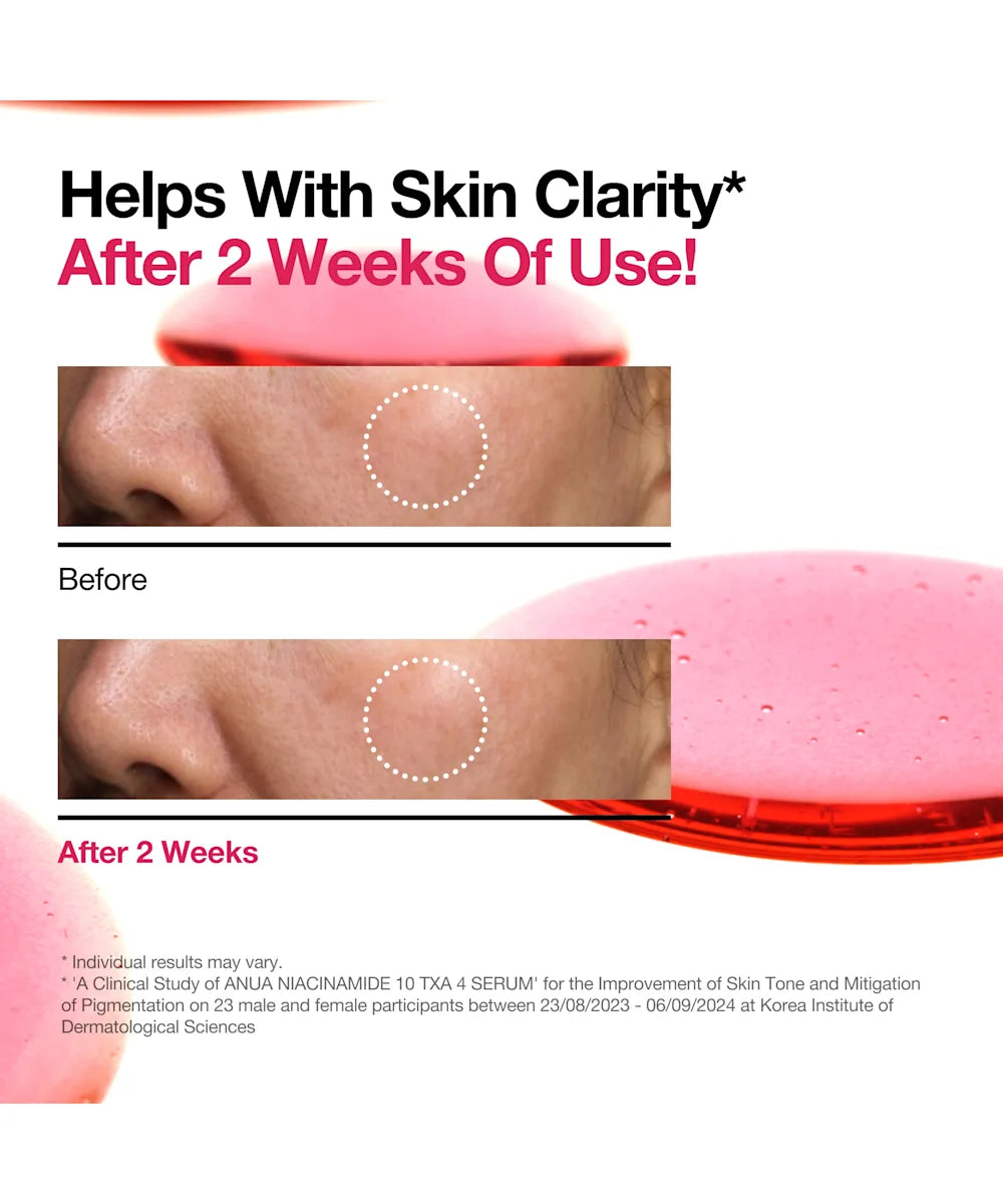ANUA Niacinamide 10% + TXA 4% serum 30 ml