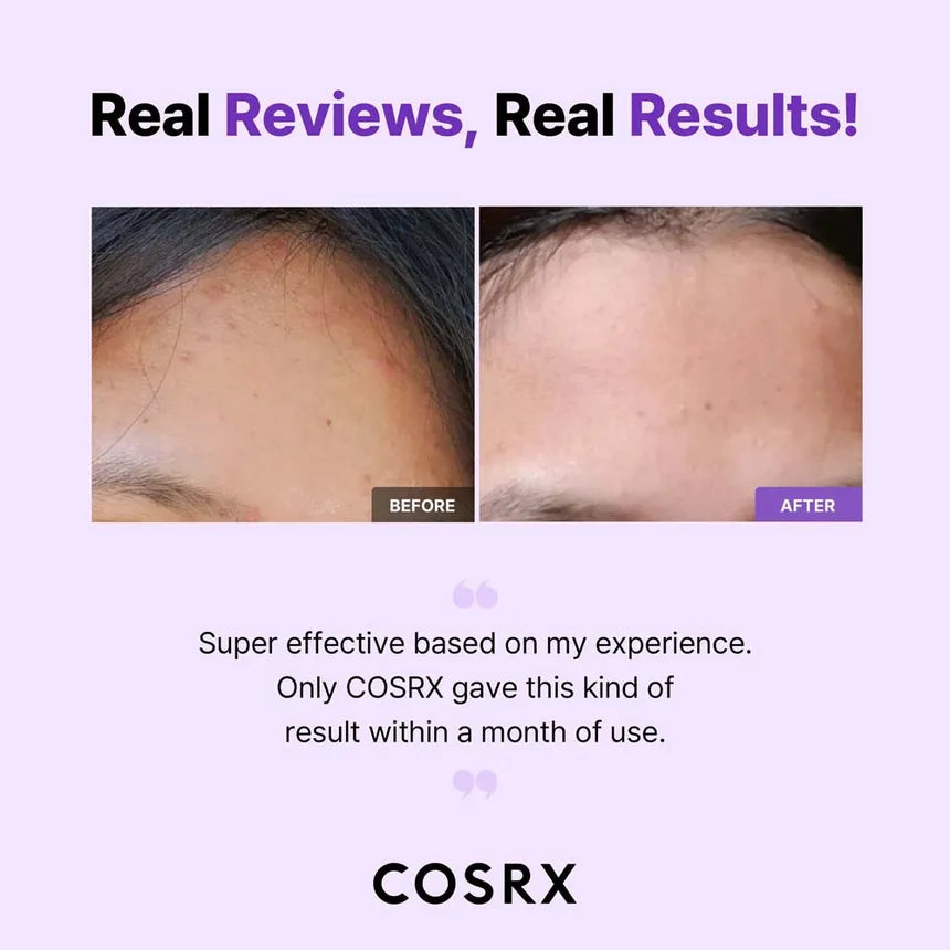 COSRX AHA/BHA Clarifying Treatment Toner 150ml