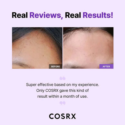 COSRX AHA/BHA Clarifying Treatment Toner 150ml