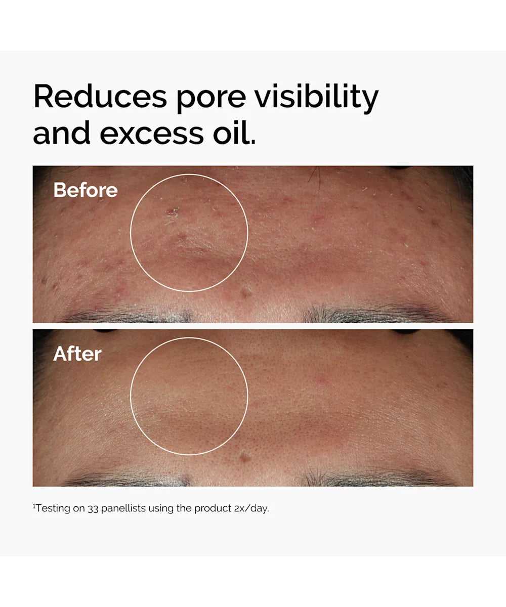 The Ordinary Niacinamide 10% + Zinc 1% 30ml