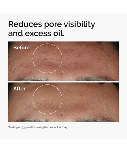 The Ordinary Niacinamide 10% + Zinc 1% 30ml