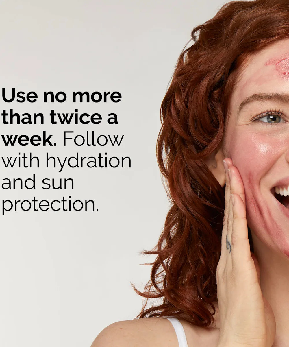 The Ordinary AHA 30% + BHA 2% Peeling Solution  30ml